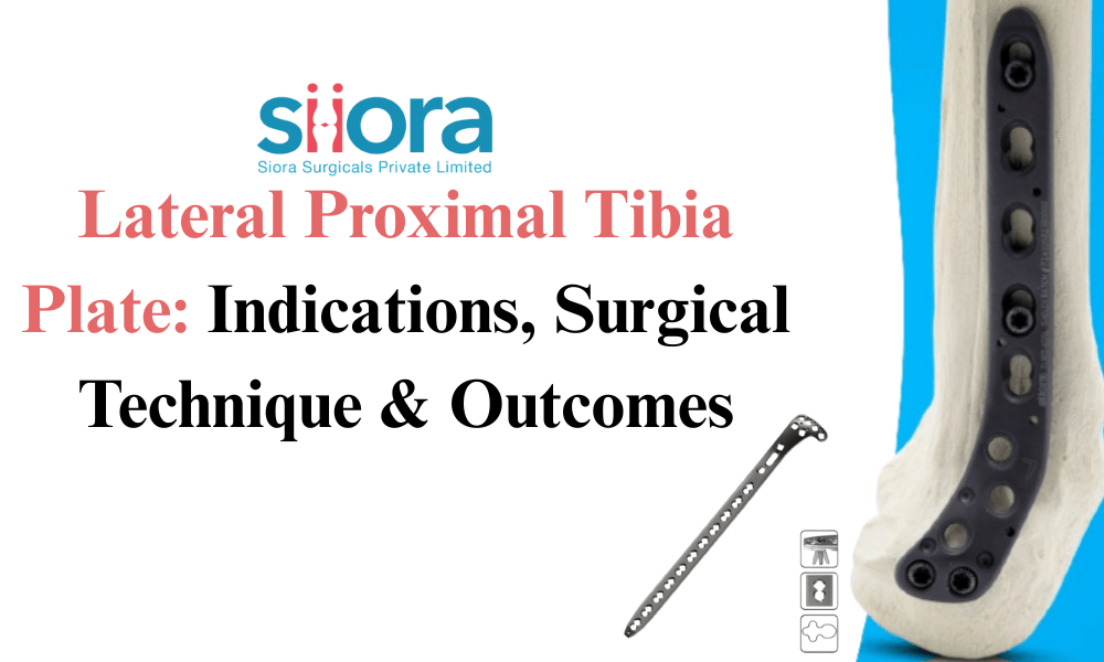 Lateral Proximal Tibia Plate